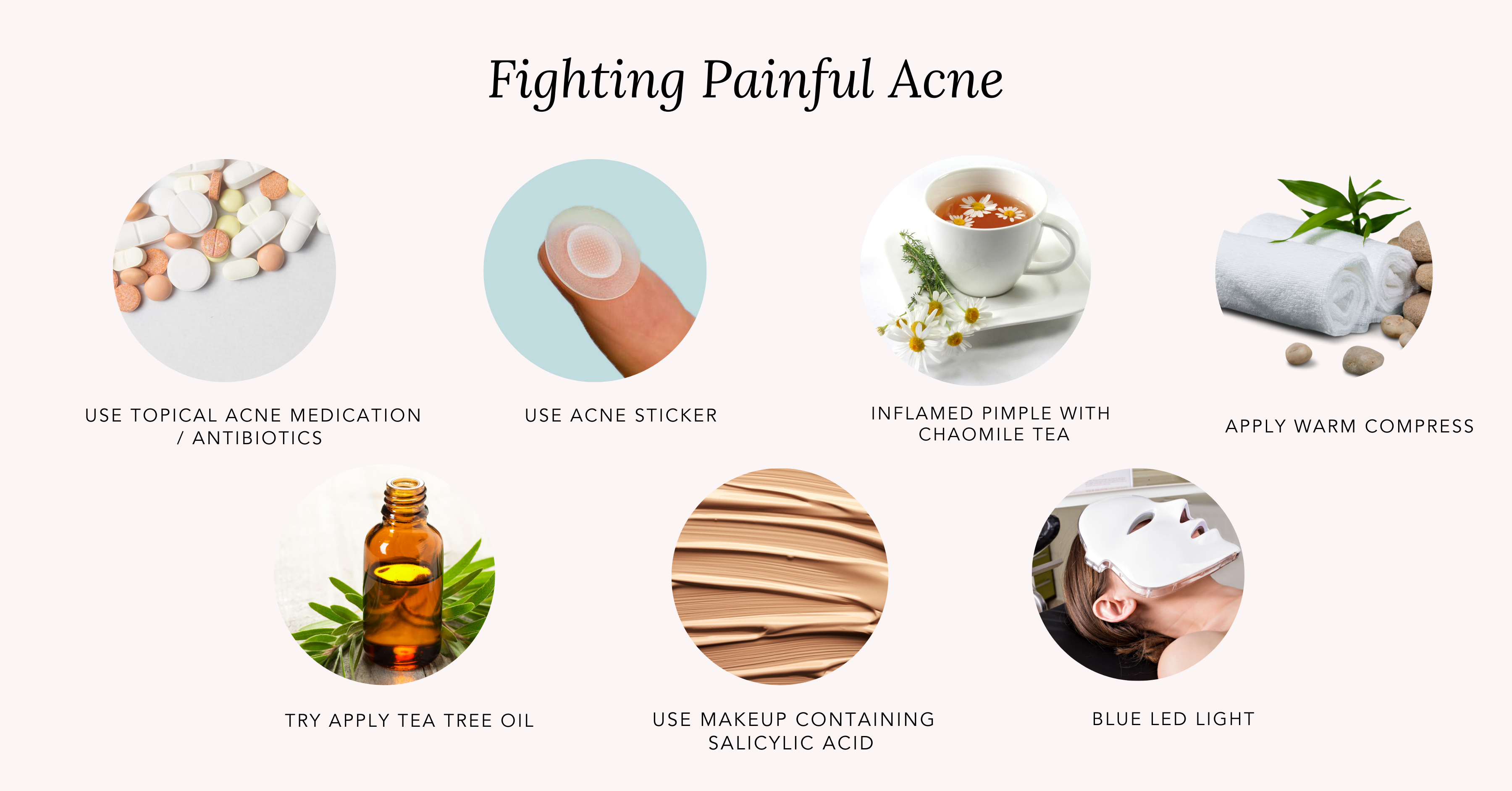 Home Remedies for Painful Pimples & Cystic Acne